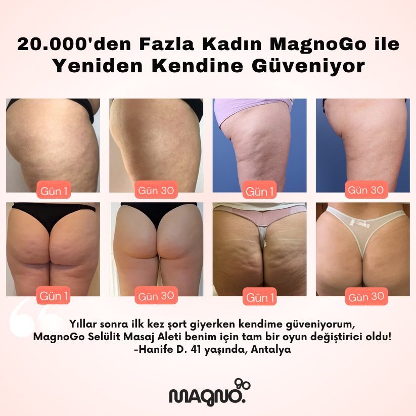 MagnoGo™ Selülit Masaj Aleti